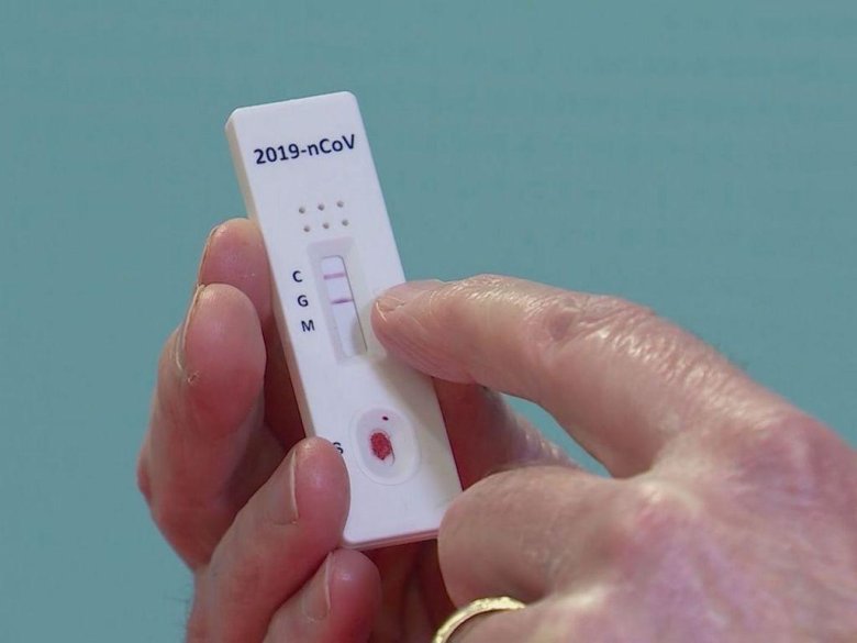 Результаты экспресс теста на ковид