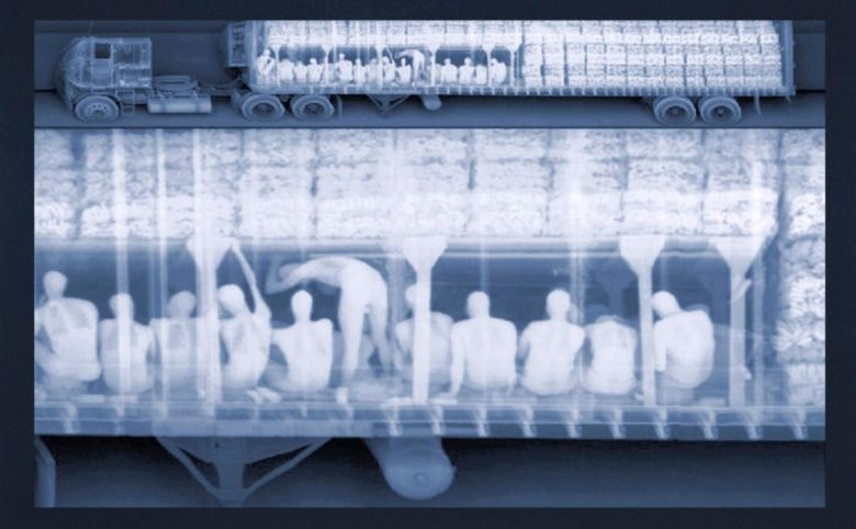 Рентген фуры