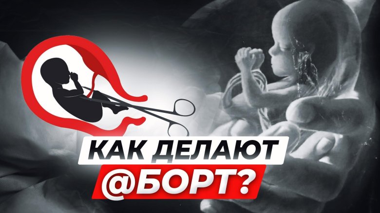 Делают аборт