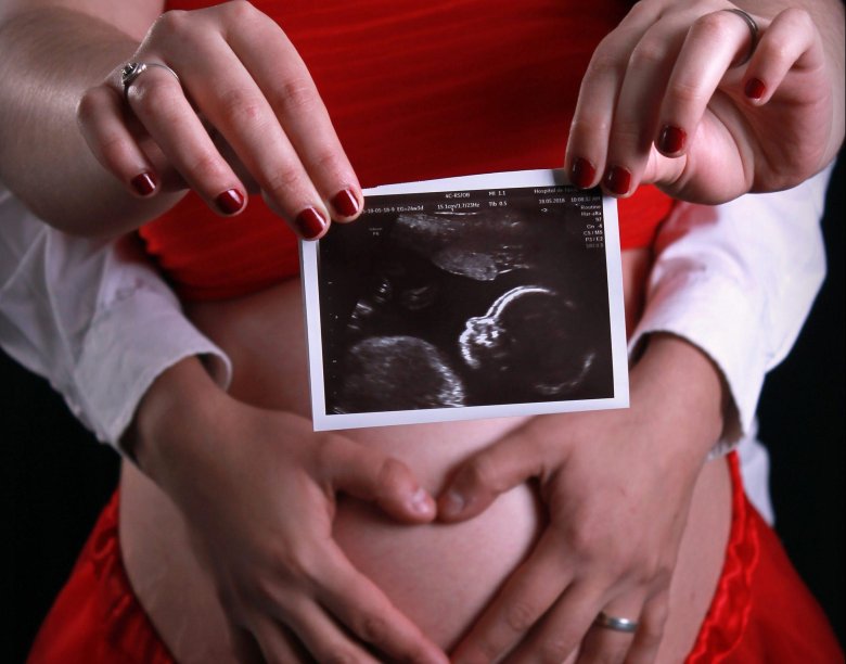 Узи беременности